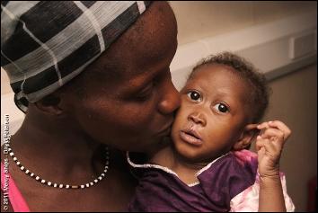 BabyBarbara after surgery