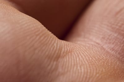 Electro for skin bovie